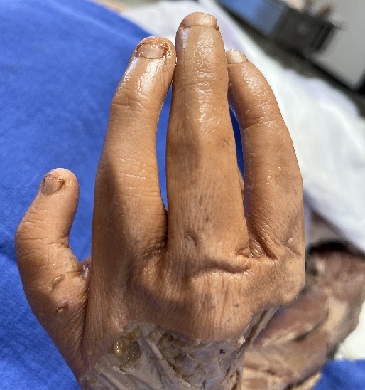 A close up of a hand AI-generated content may be incorrect.