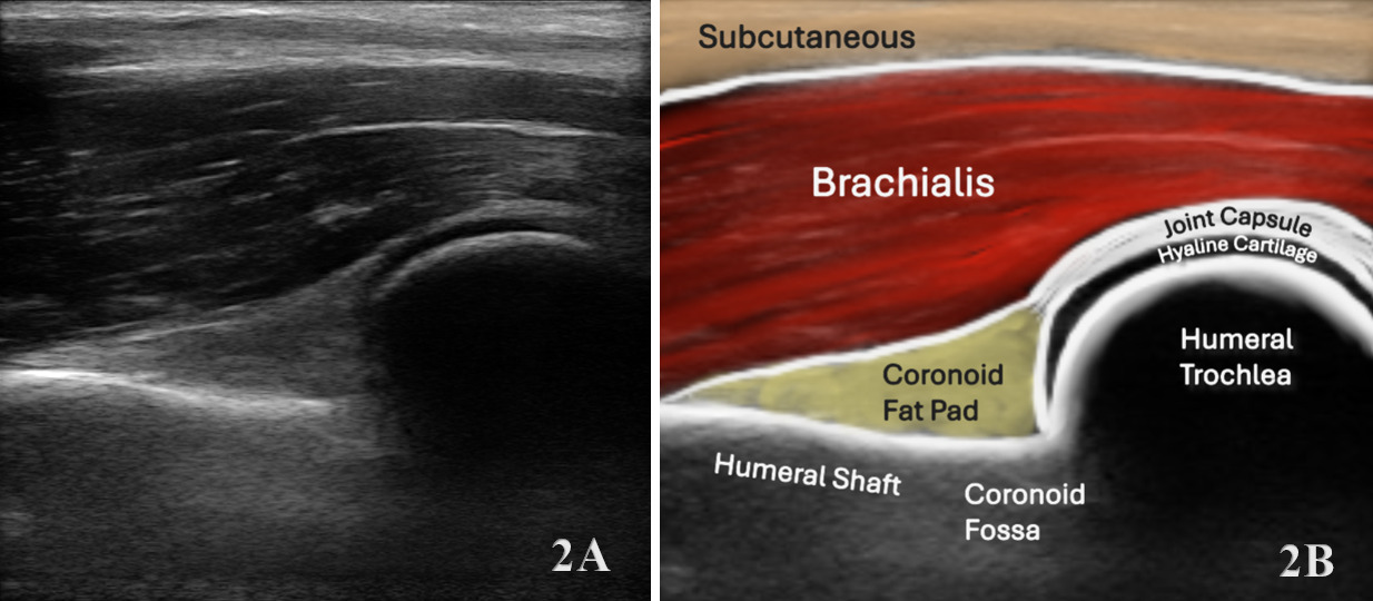 A close-up of a medical image AI-generated content may be incorrect.