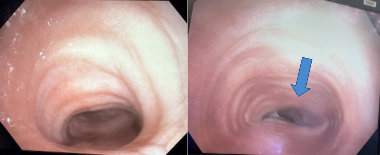 Close up of a person's body Description automatically generated