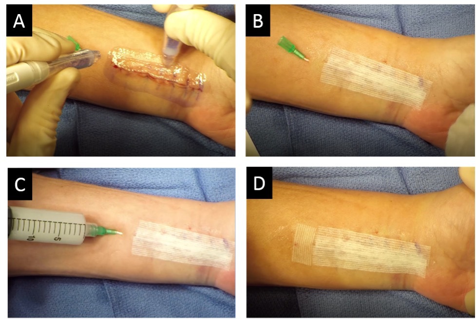 A close-up of a person's arm AI-generated content may be incorrect.