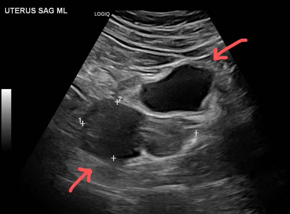 Figure 2B