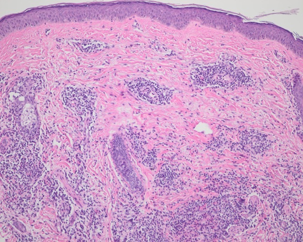 Figure 2B
