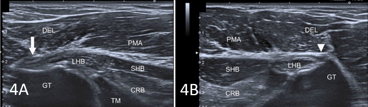 MSK Ultrasound: A Powerful Tool for Evaluating and Diagnosing ...