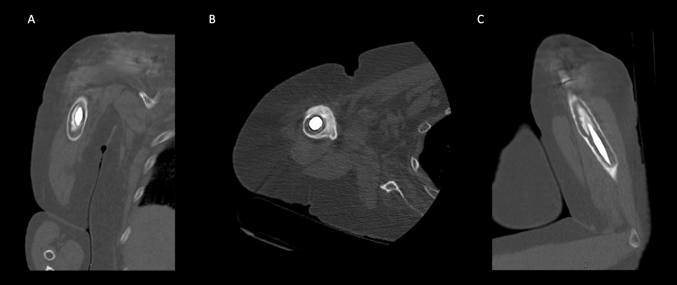 Figure 15