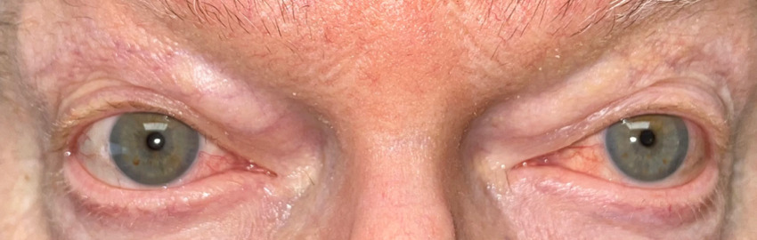 Close up of a person's eyes AI-generated content may be incorrect.