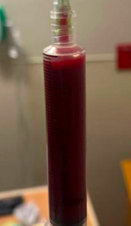 A test tube with a red liquid in it AI-generated content may be incorrect.