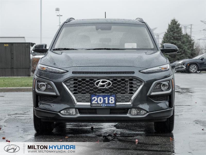 hyundai Kona 2018 - 2