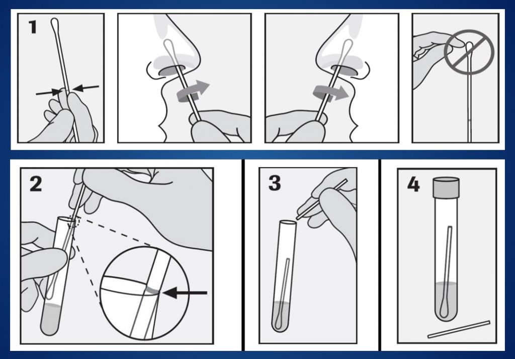 OnsiteGene 1 Protocol Nasal Direct