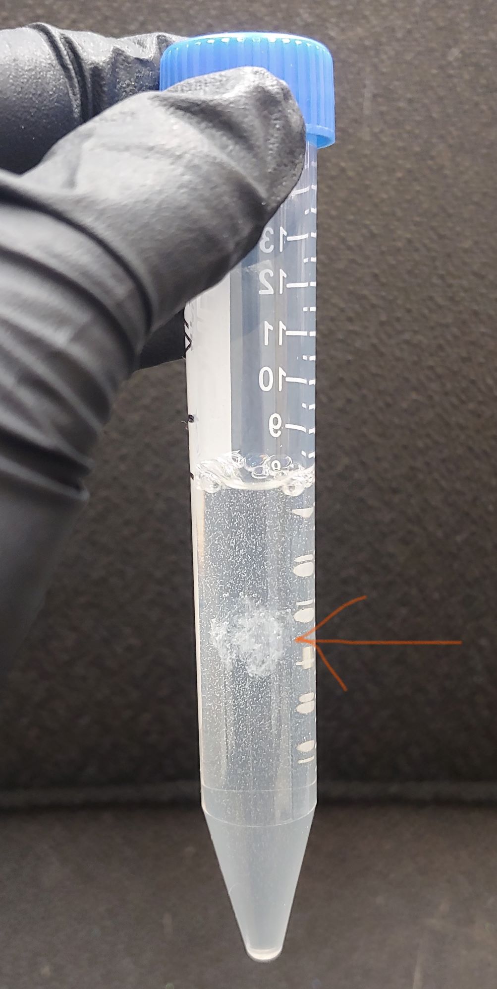 DNA extraction from whole blood using simple salting out procedure