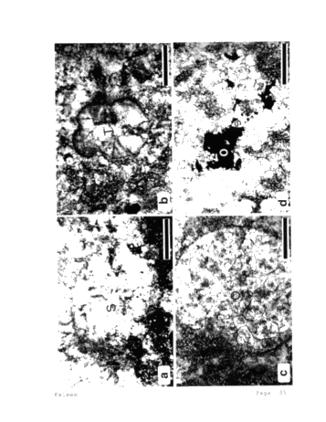 Role of Carbonate Diagenesis and Halite Plugging on the Reservoir Quality of Middle Silurian Reefal Dolomites Page 35