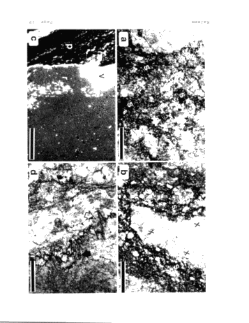 Role of Carbonate Diagenesis and Halite Plugging on the Reservoir Quality of Middle Silurian Reefal Dolomites Page 38