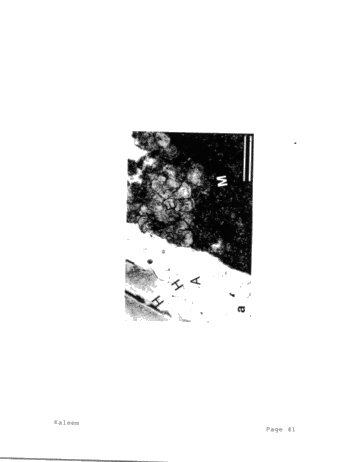 Role of Carbonate Diagenesis and Halite Plugging on the Reservoir Quality of Middle Silurian Reefal Dolomites Page 40