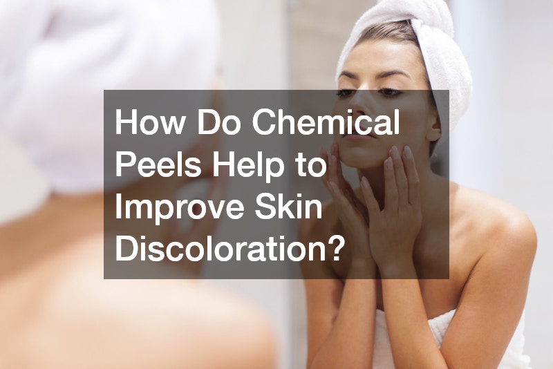 How Do Chemical Peels Help to Improve Skin Discoloration?