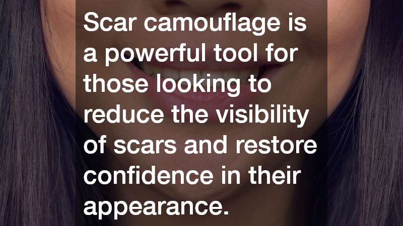 Scar camouflage is a powerful tool for those looking to reduce the visibility of scars and restore confidence in their appearance. 