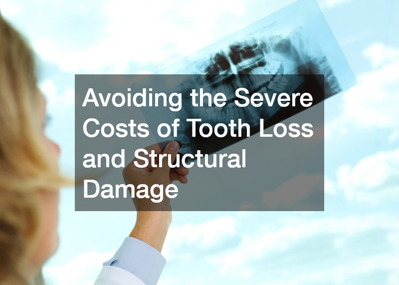 Avoiding the Severe Costs of Tooth Loss and Structural Damage