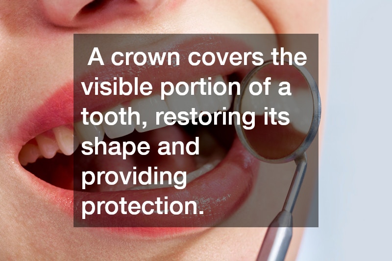 A crown covers the visible portion of a tooth, restoring its shape and providing protection.
