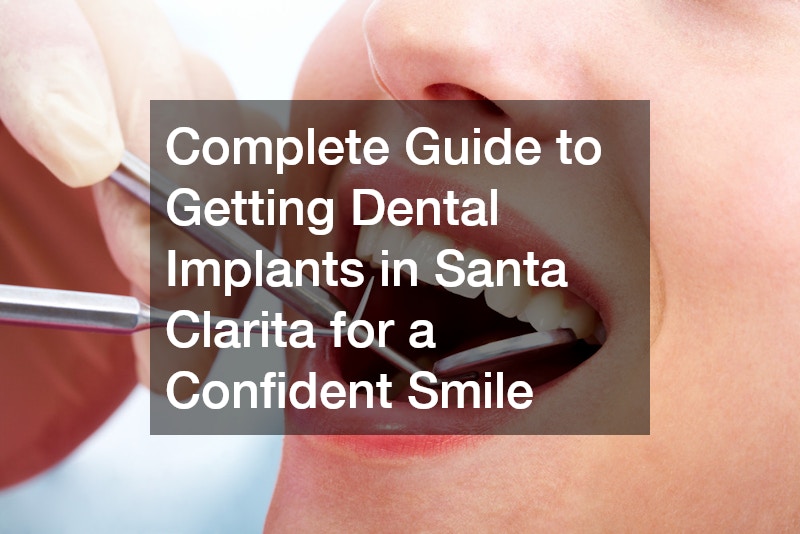 Complete Guide to Getting Dental Implants in Santa Clarita for a Confident Smile