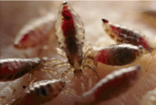 Body Lice Body Lice