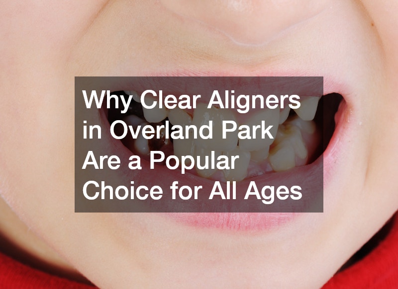 Why Clear Aligners in Overland Park Are a Popular Choice for All Ages