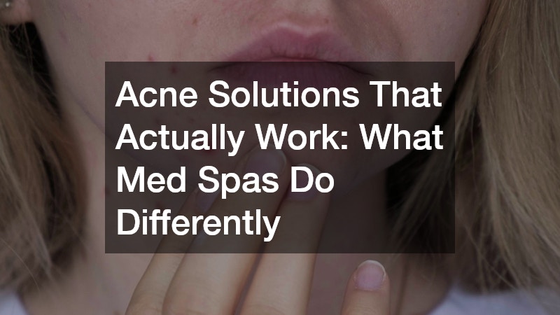 Acne Solutions That Actually Work: What Med Spas Do Differently