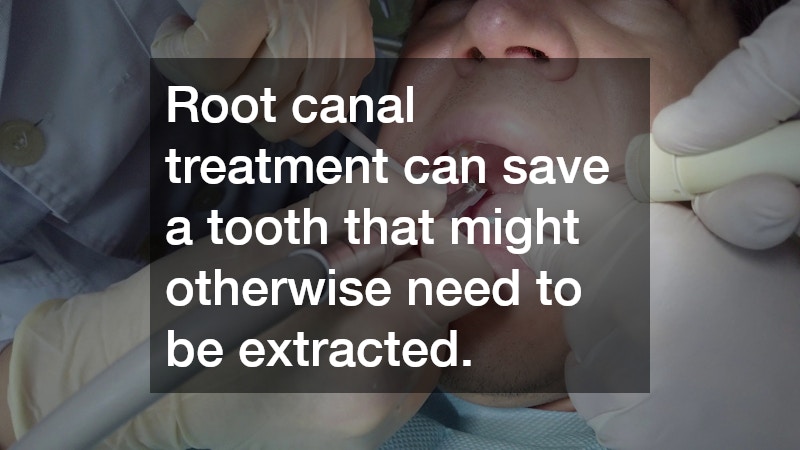 Root canal treatment can save a tooth that might otherwise need to be extracted.