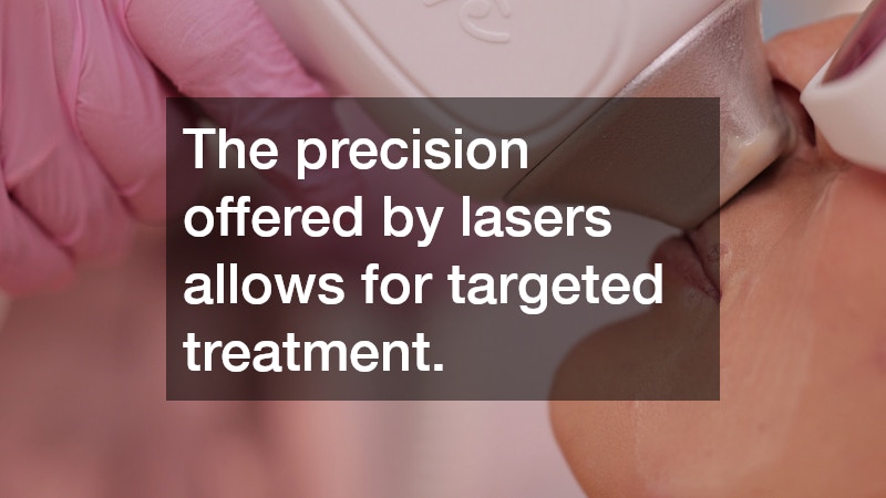 The precision offered by lasers allows for targeted treatment.