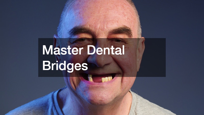 Master Dental Bridges