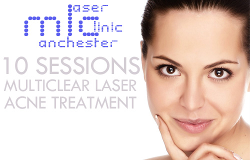 Kick spots into touch with ten Multiclear acne laser sessions for �225