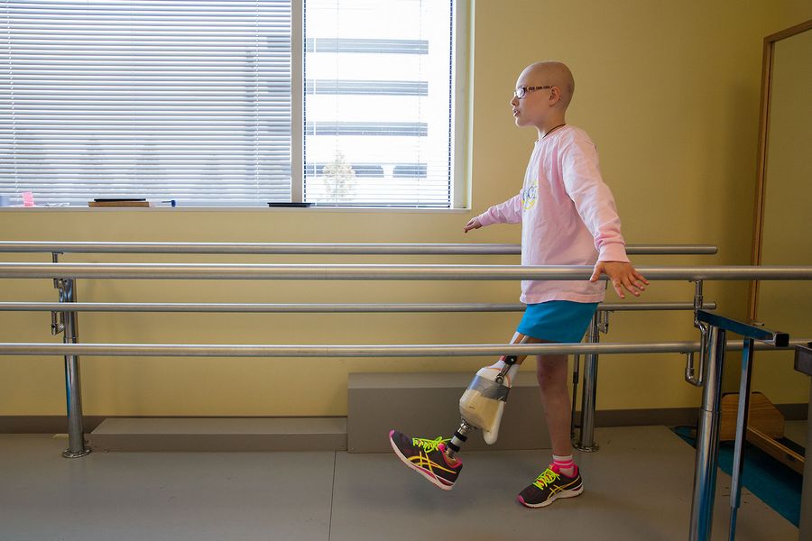 grace-osteosarcoma-prosthesis