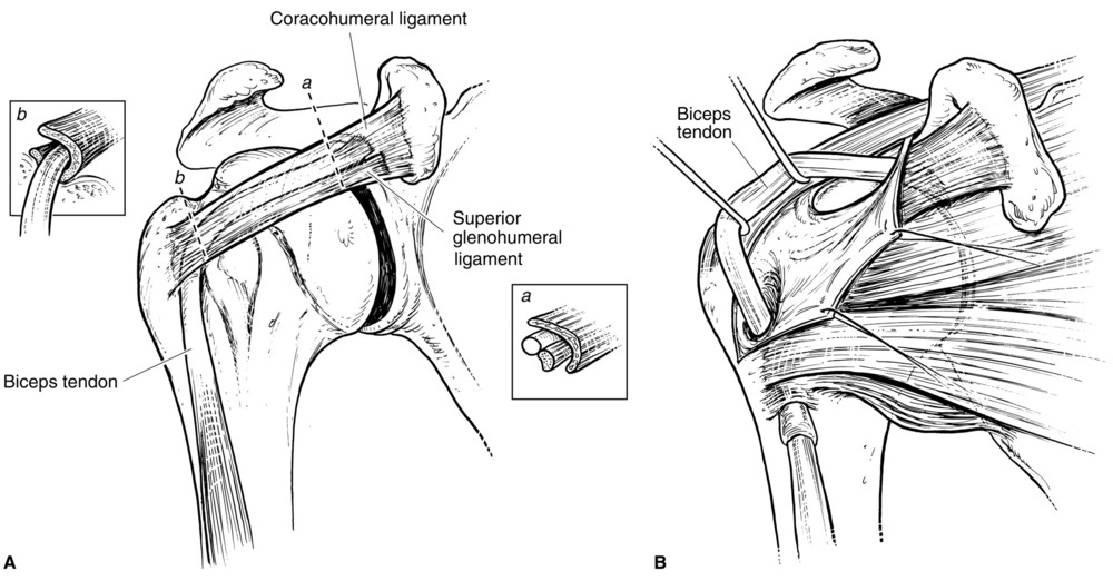 E. Ligaments Glenohumeral Joint (Outline) Meaning