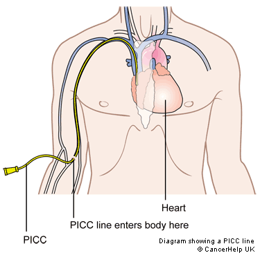 what does picc line stand for in medicine