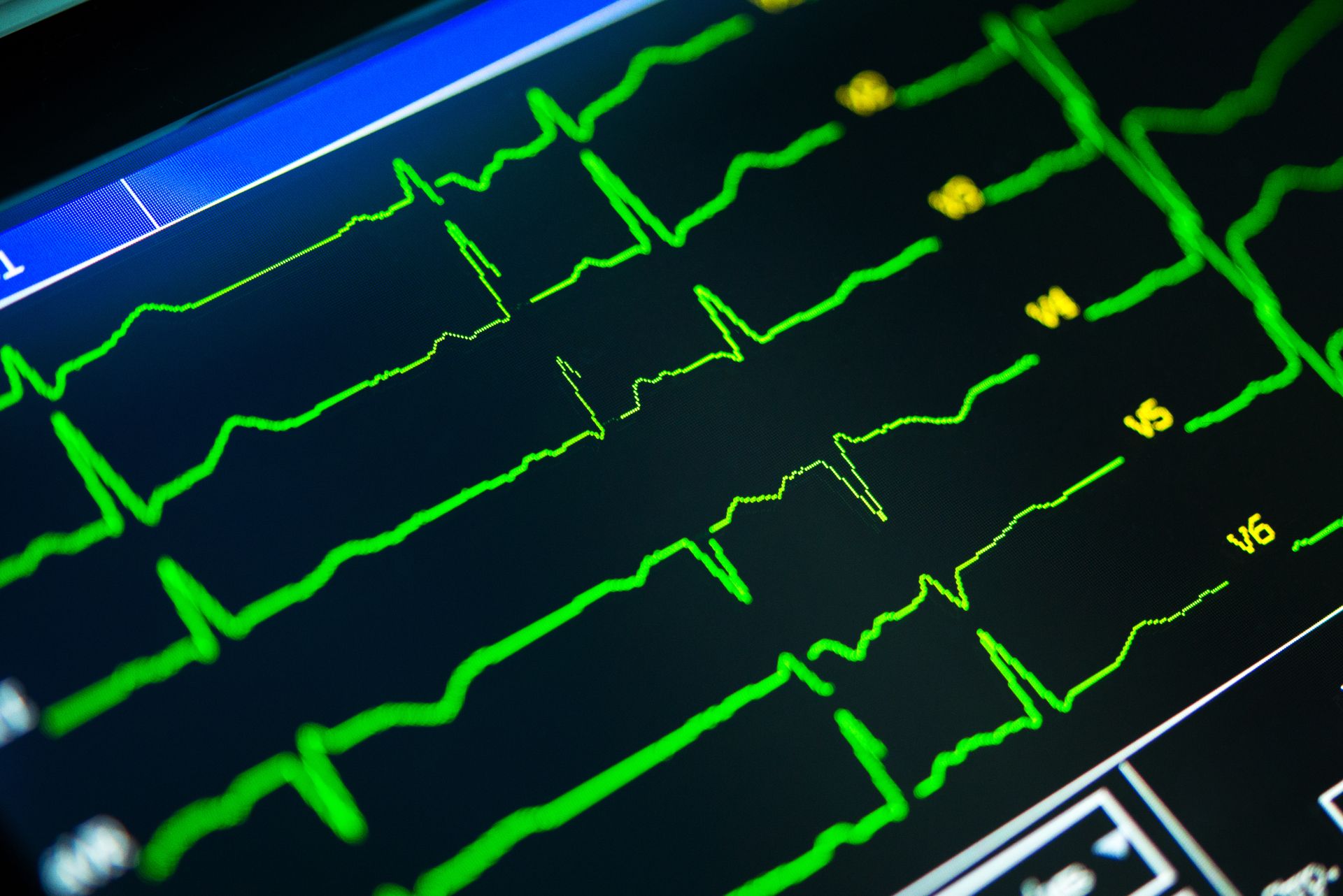 Take Control and do an Inventory Health Check