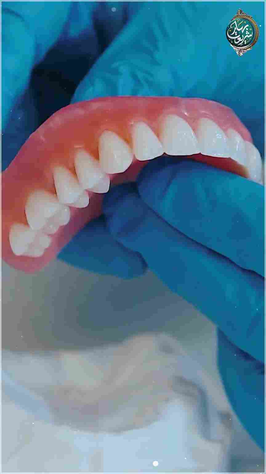 Artificial Teeth Mein Wuzu Aur Ghusl Ka Hukum Image