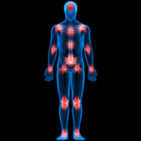 Coffee May Not Be Quite As Anti-Inflammatory As Once Thought