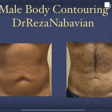 cosmetic surgeon santa monica ca