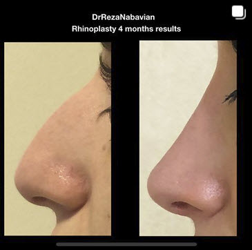 plastic surgeons in santa monica california 