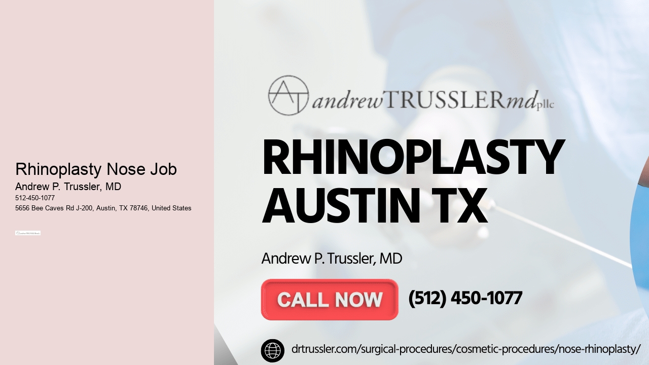Rhinoplasty Nose Job Andrew P. Trussler, MD Rhinoplasty Nose Job