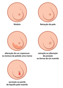 Auto Exame - Outubro Rosa