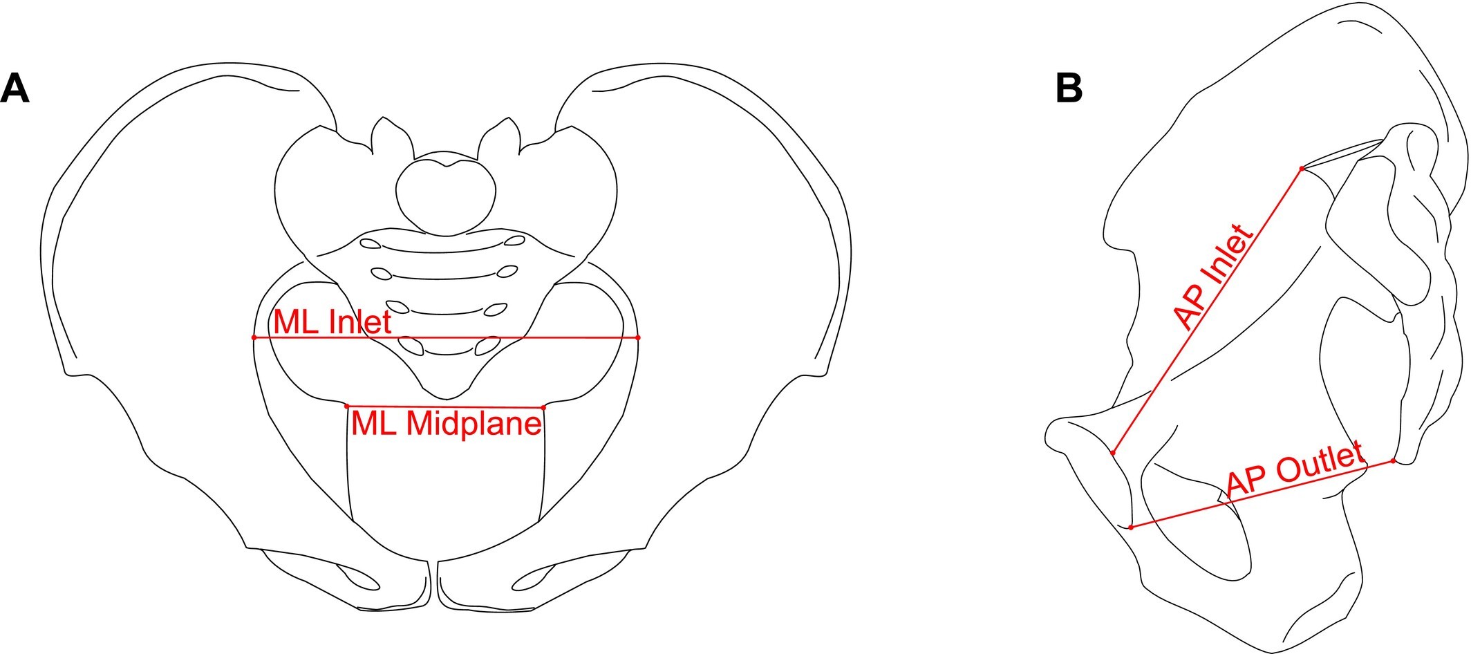Figure from the manuscript showing the four pelvic cavity dimensions measured in the study.