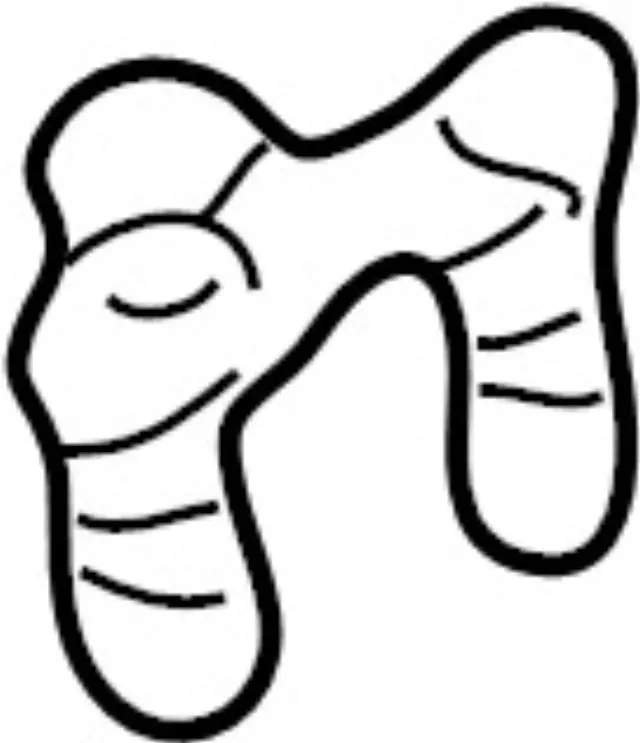 Lower Control Arm Bolt Plate