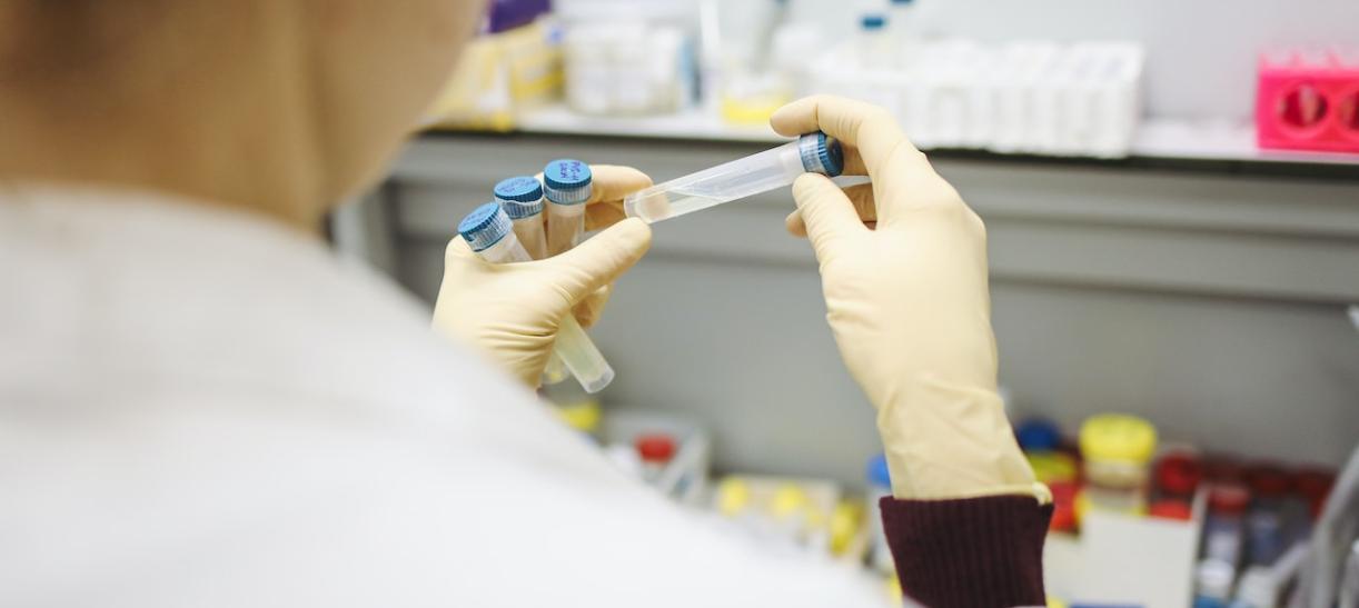 Laboratorio analizando polio