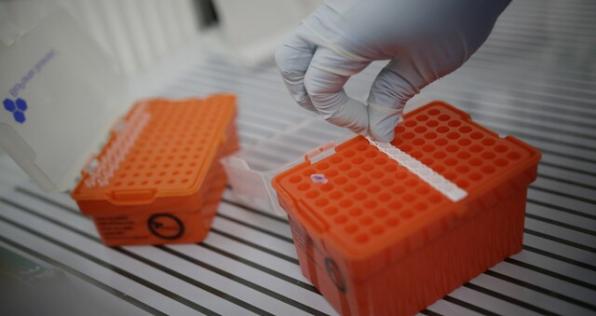 ¿Sabes cuáles son los síntomas de la viruela símica? Te ayudamos a reconocerlos