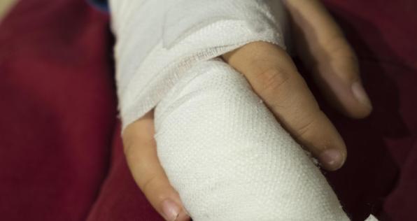 ¡Que la pólvora no arruine la fiesta! Consejos para proteger a los tuyos