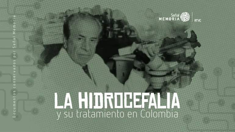La hidrocefalia