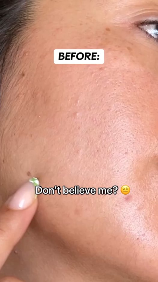 Purito Panthenol Cream - Before & After Concept