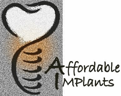 Affordable Dental Implants Logo