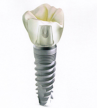 Utah Association of Oral and Maxillofacial Surgery Logo