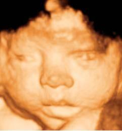 Clear Image 4D Ultrasound Logo