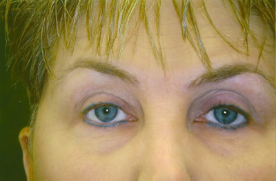 Always-Pleasing Permanent Make-up Image