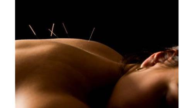 Shelley Tsai Acupuncture & Herbal Image